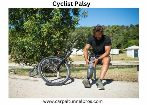 ChatGPTAre you experiencing discomfort and tingling in your hands after long bike rides? You might be dealing with Cyclist's Palsy, also known as Handlebar Palsy. This condition occurs due to prolonged pressure on the ulnar nerve, which runs through the wrist and into the hand. In this informative guide, we'll delve into the causes, symptoms, and prevention strategies for Cyclist's Palsy. Visit for more -https://carpaltunnelpros.com/conditions/sports-injuries