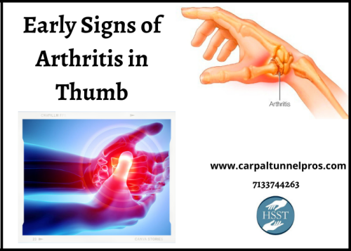 If you feel the stiffness and pain in your thumb, it could be a sign of arthritis. The Arthritis Pain Relief Wrap is a medical grade device that helps to reduce the pain and inflammation in the thumb. Learn more about these early signs at www.carpaltunnelpros.com and find the right arthritis treatment for you.
https://carpaltunnelpros.com/conditions/osteoarthritis-of-the-thumb-joint