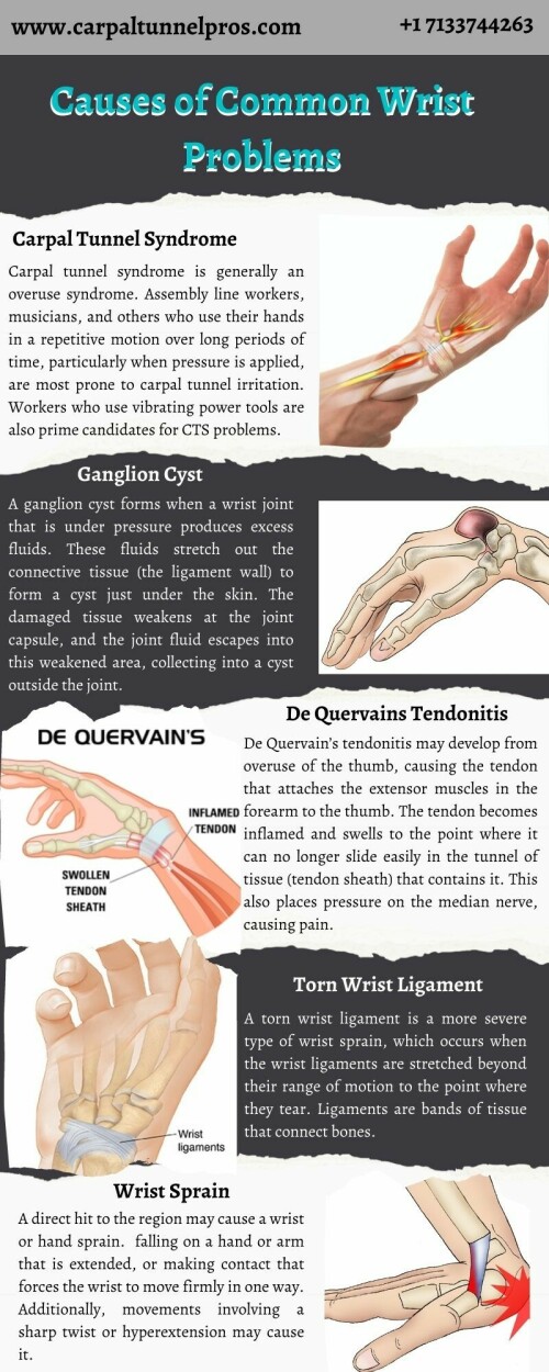 Wrist pain is often caused by sprains or fractures from sudden injuries. But wrist pain can also result from long-term problems, such as repetitive stress, arthritis and carpal tunnel syndrome. If you want to get to know more than visit www.carpaltunnelpros.com