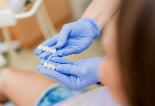 Unleash the true potential of your smiles with Teeth Savers offering the best treatment of all on 4 dental implants Tijuana Mexico. The one-of-a-kind all-on-4 Dental Implants deliver a full-arch prosthesis using only four implants. This unique dental treatment aims to furnish edentulous patients with a stable, prompt, and optimally functioning set of teeth. The advantages of this treatment are multifold, including immediate results, a one-of-a-kind design of straight and angled multi-unit abutments, and feasible costs. Again, the skilled dental team is expert in detecting, diagnosing, and treating cavities effectively using ultramodern technology and tools. Moreover, the gentle patient-centric approach ensures a hassle-free experience for the patients.  Visit: https://teethsavers.com/all-on-4/