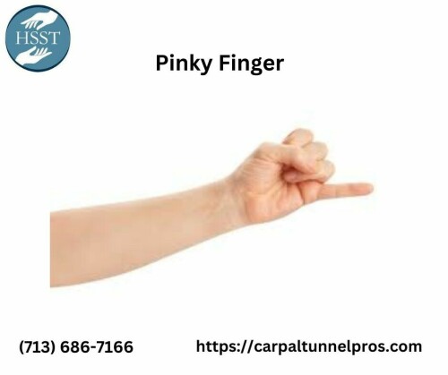 Learn about the health and usefulness of your pinky finger. Our book offers useful information on everything from anatomy to common problems and solutions. Seek advice from professionals on how to take care of your pinky finger and relieve pain. For more detail pls visit https://carpaltunnelpros.com/2020/03/23/9-signs-that-its-time-to-see-the-hand-doctor/