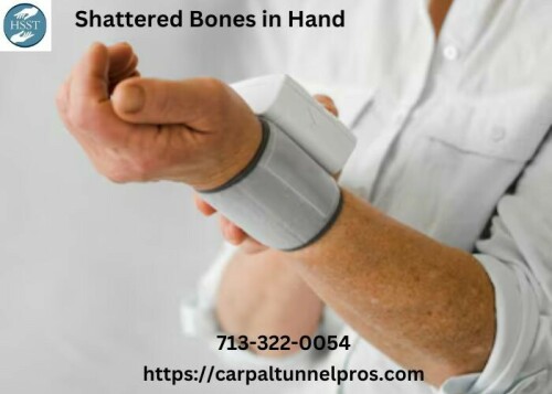 At Hand Surgery Specialists of Texas, we are experts in treating shattered bones in the hand. Our skilled team uses advanced techniques to repair fractures, restoring function and mobility. We provide comprehensive solutions for shattered bones with precise surgeries and personalized care, ensuring optimal recovery and hand health. Trust us to take care of you.
https://carpaltunnelpros.com/2020/08/31/10-ways-to-tell-if-your-hand-is-broken/