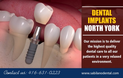 Dental Implants in North York natural-looking solution for missing teeth at http://sabilanodental.com/

Service
dentist North York
General dentistry North York
Dental Implants North York
Porcelain Veneers North York

A Dental Implants in North York is a fixture that is embedded within the jaw bone and replaces natural teeth by supporting a prosthesis, such as a crown or removable or fixed denture. After the placement of dental implants, bone formation occurs in the surroundings of the implant, resulting in firm anchorage and stability of the artificial tooth.

Office: 416-631-0223 
Fax: 416-631-6531 
Email: drrsabilano@rogers.com 

Find us-
https://goo.gl/maps/JZ7kE1sh3KD2

Social
http://www.alternion.com/users/dentistNorthYork/
https://padlet.com/TeethwhiteningFishers
https://www.crunchyroll.com/user/TeethwhiteningFishers
https://www.ted.com/profiles/12443539
https://kinja.com/dentalimplantsnorthyork