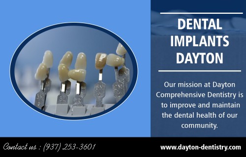 Dental Implants in Dayton - An Affordable Way to Replace a Missing Tooth At https://www.dayton-dentistry.com/contact/dayton-oh-office/

Find Us: https://goo.gl/maps/s6juyb3BgEM2

Deals in.

Dentist Dayton
Dental Implants Dayton
Botox Dayton
Cosmetic Dentist Dayton
Professional Teeth Whitening Dayton
Family Dentist In Dayton

Dental implants are the best way to replace missing teeth. For the most part, the dental implant is a successful venture for most patients. Dental Implants in Dayton is now the standard of care for tooth replacement, improving the dental health of millions of people with missing teeth. Implants have also significantly affected dental economics with an increasing number of dental practices and companies offering their services and products. 

Dayton Comprehensive Dentistry
5395 Burkhardt Road
Dayton, OH 45431
Phone: (937) 253-3601

Social---

http://www.alternion.com/users/DentalImplantsDayton
https://www.yumpu.com/user/EmergencyDentistDayton
http://drcoreysellers.brandyourself.com/
http://www.apsense.com/brand/DaytonComprehensiveDentistry