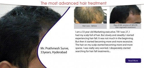 Get the Most Advance Hair Treatment by Dr. Rinky Kapoor