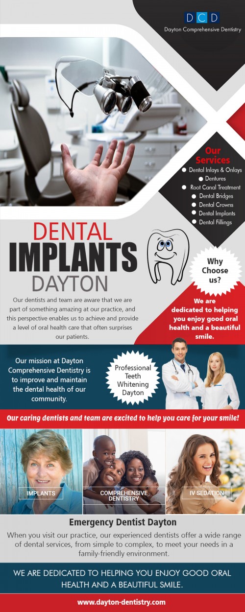 Dental Implants Dayton